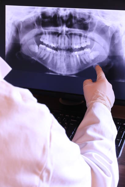Best Emergency Dental Extractions in Fulton, TX