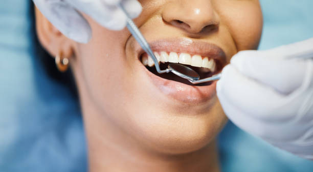 Best Weekend Emergency Dentist in Fulton, TX