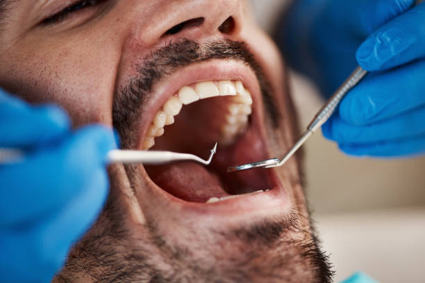 Best Broken or Cracked Tooth Emergency Dentist in Fulton, TX
